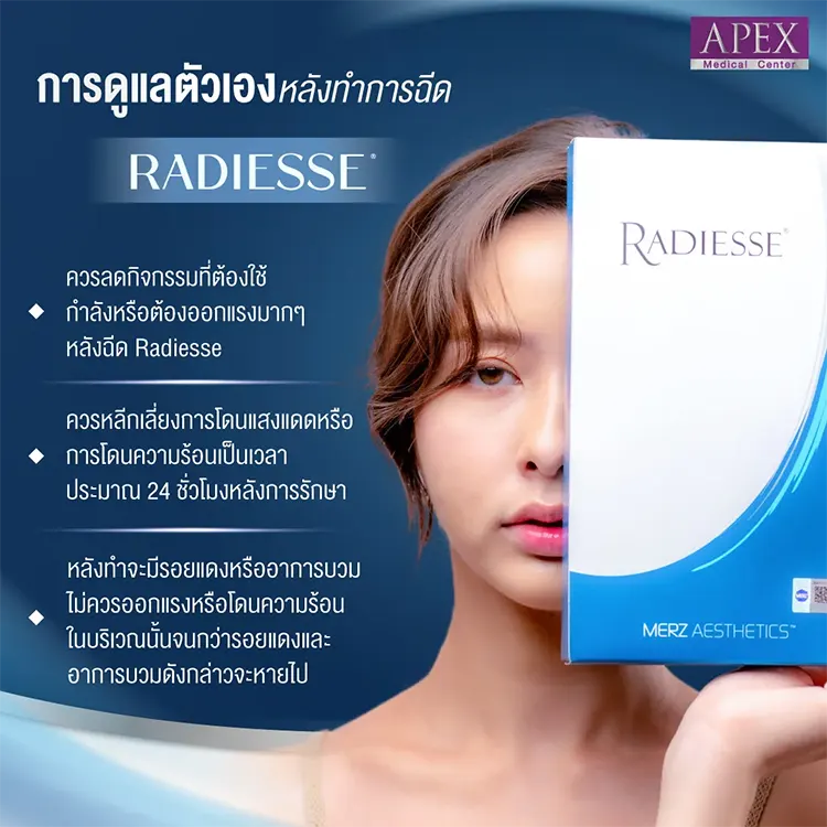 radiesse