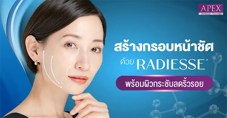 radiesse