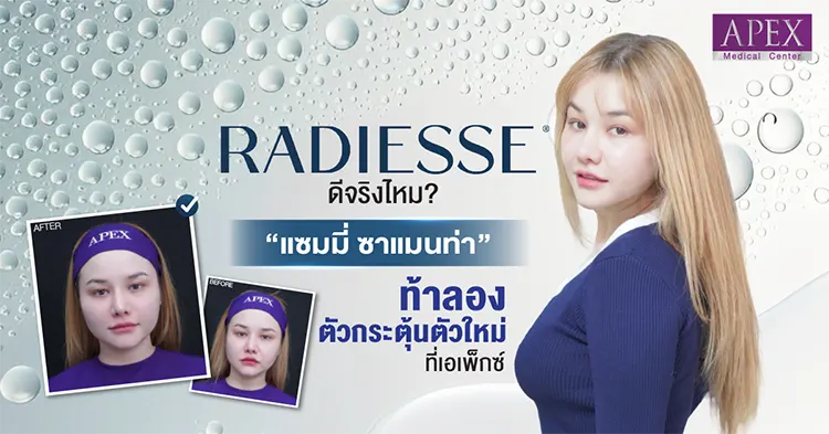 Radiesse คุณแซมมี่ ซาแมนท่า