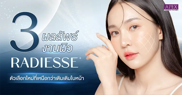 Radiesse