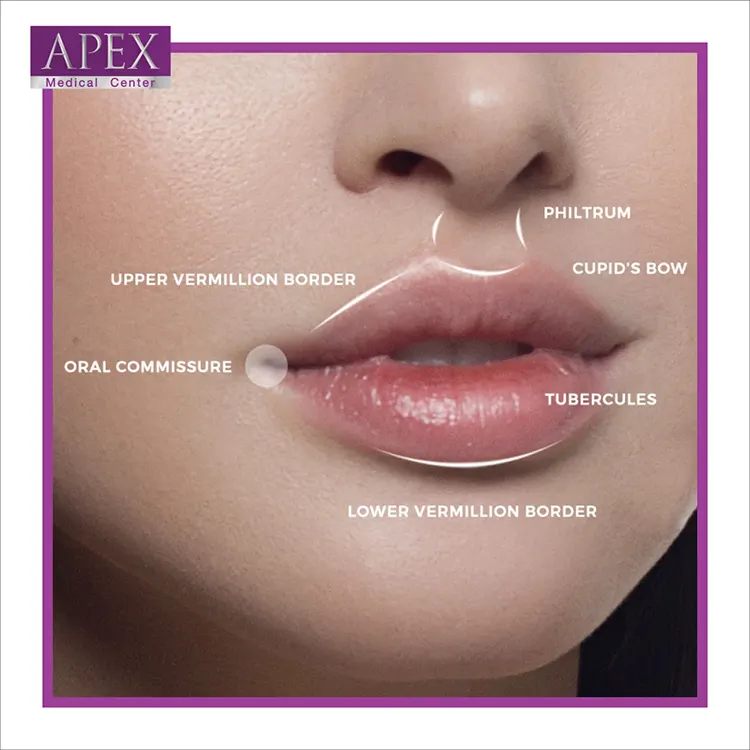 รีวิวฉีดฟิลเลอร์ปากกระจับ คุณพัด