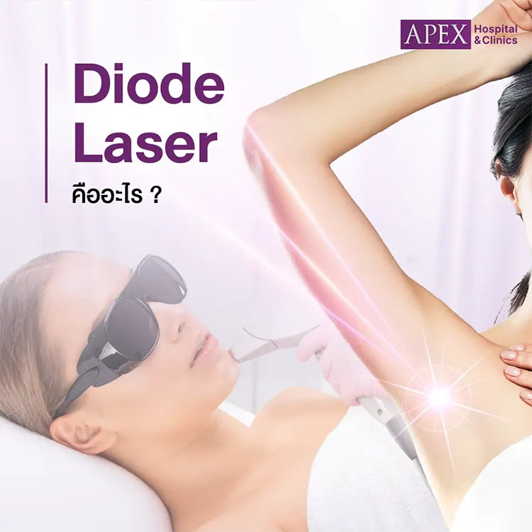 Diode Laser