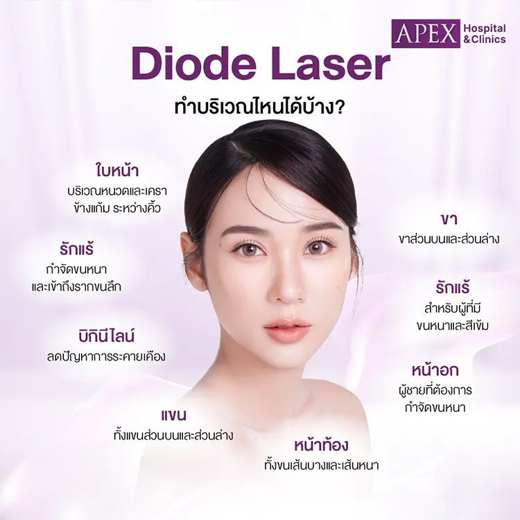Diode Laser
