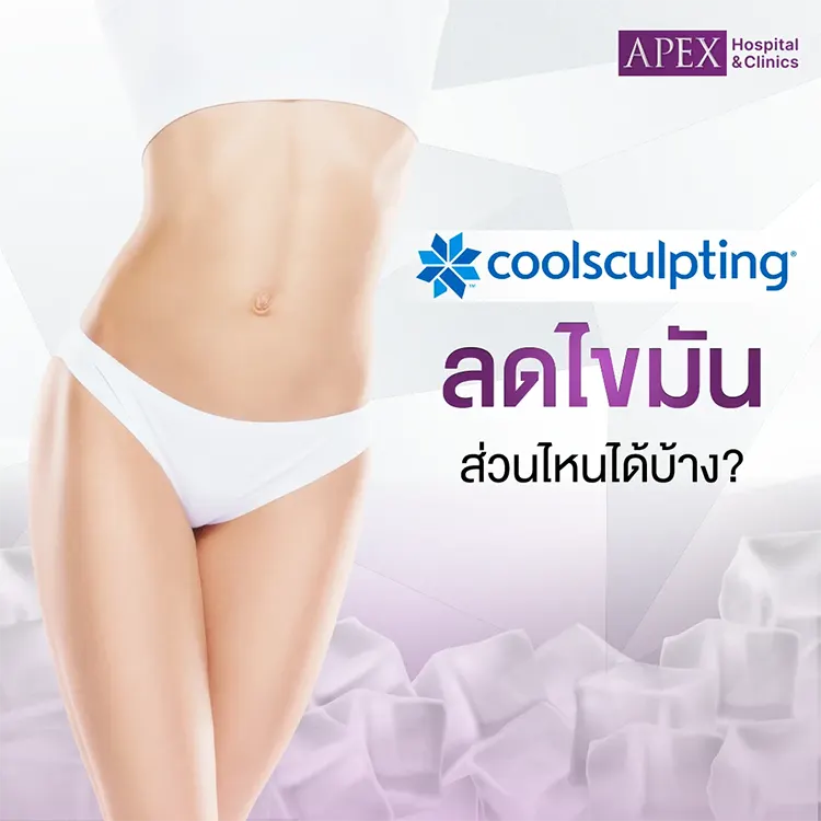 CoolSculpting