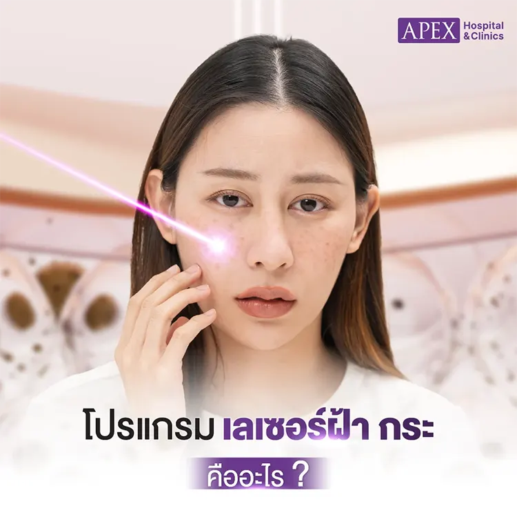 เลเซอร์ฝ้า กระ ราคา