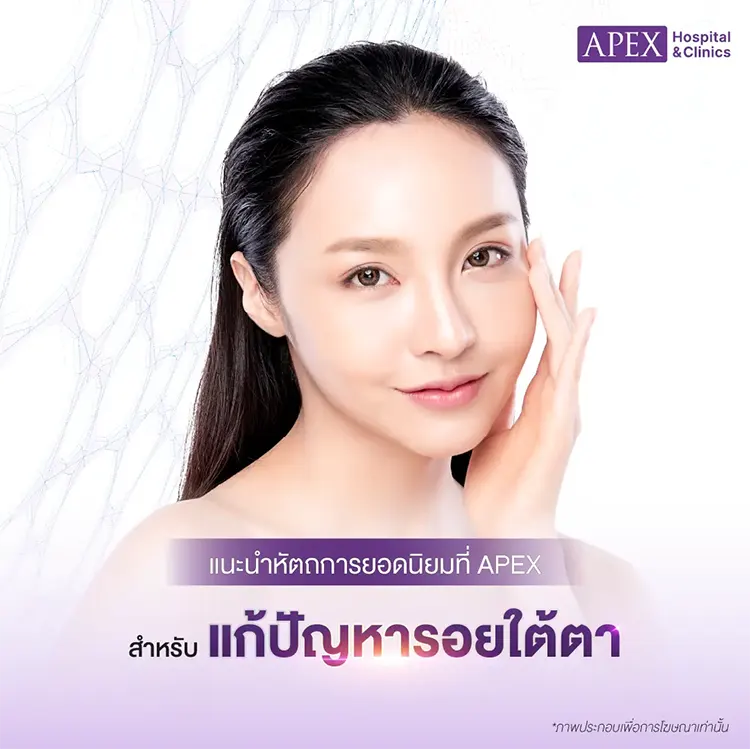 รอยใต้ตา