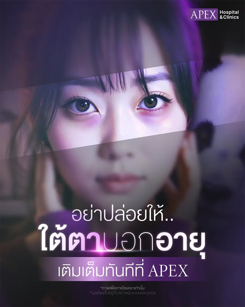 ฉีดฟิลเลอร์ใต้ตา