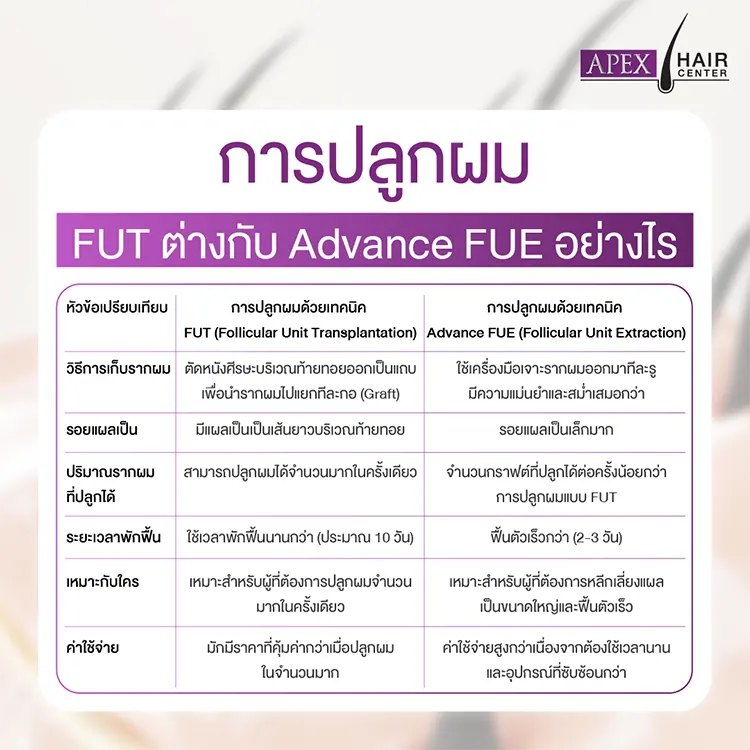 ปลูกผม Advance FUE