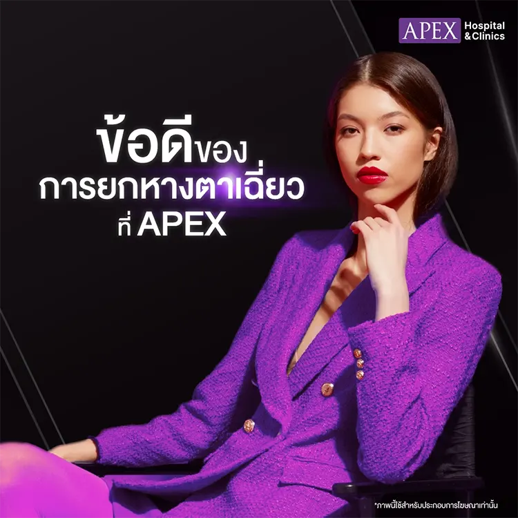 ตาเฉี่ยว