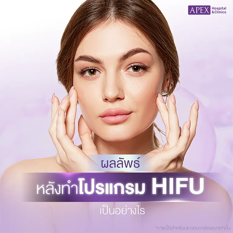 Hifu ราคา