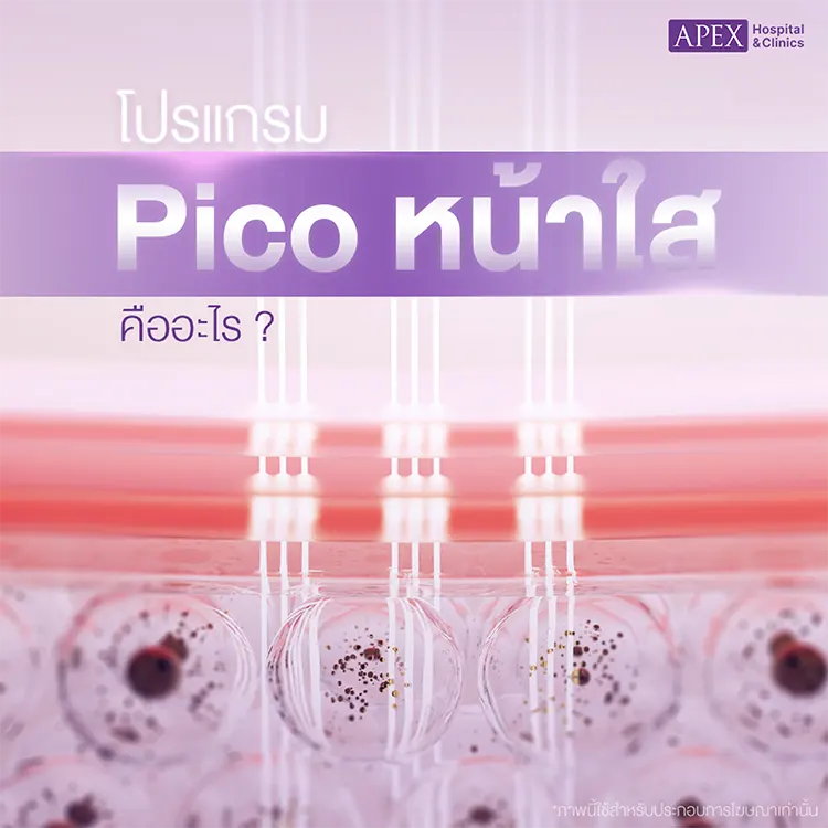 Pico หน้าใส