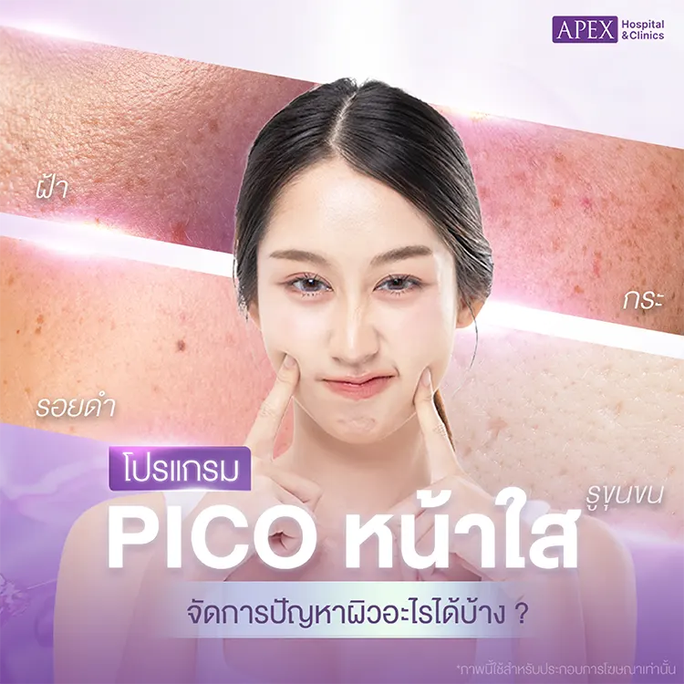 Pico หน้าใส