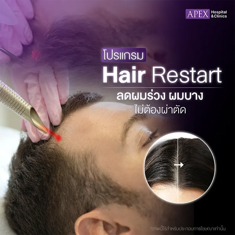 รักษาผมร่วงผมบางราคา