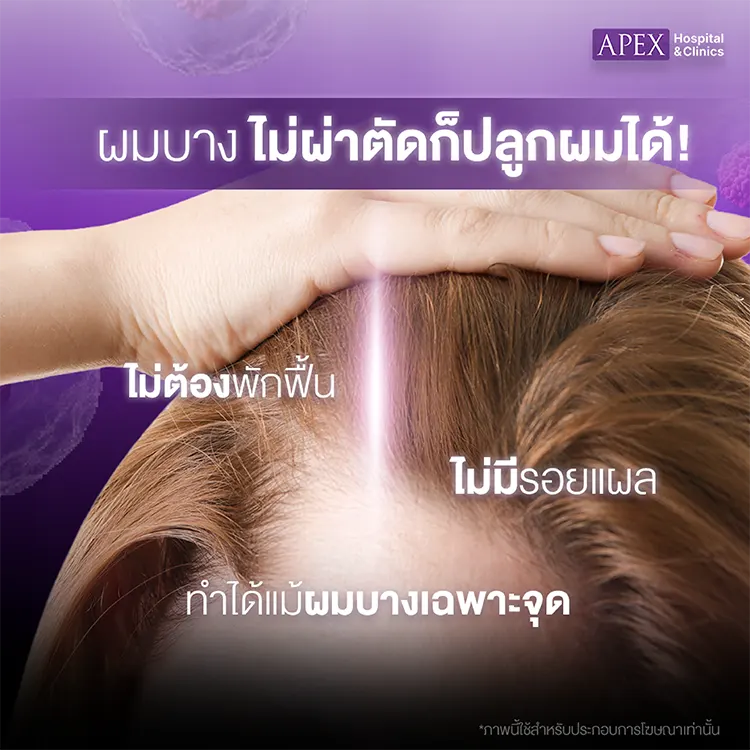 รักษาผมร่วงผมบางราคา