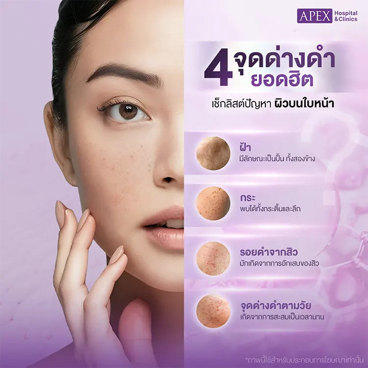 จุดด่างดำ