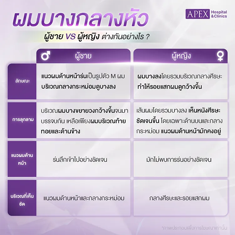 ผมบางกลางหัว