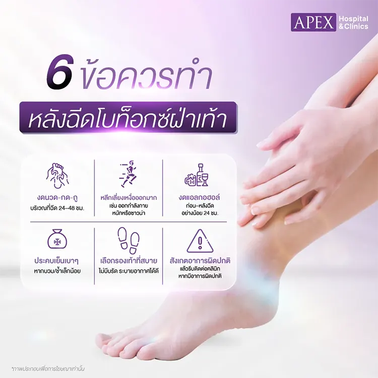 ฉีดโบท็อกซ์ฝ่าเท้า