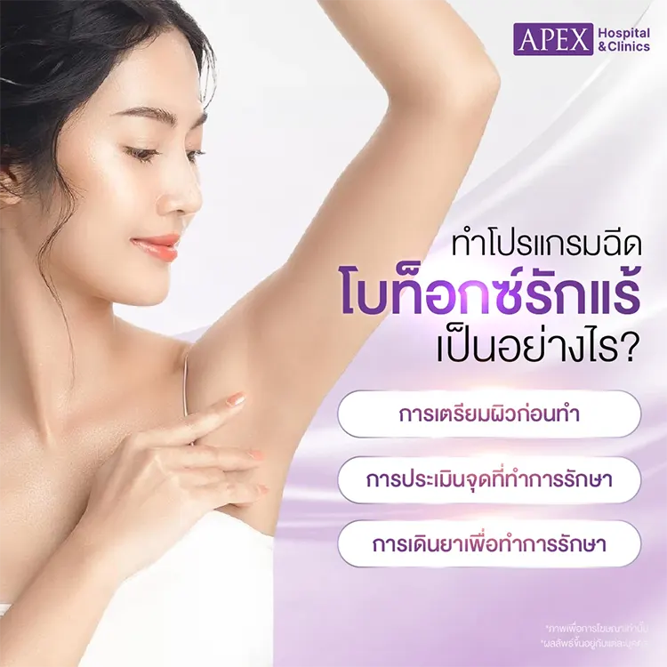 ฉีดโบท็อกซ์รักแร้