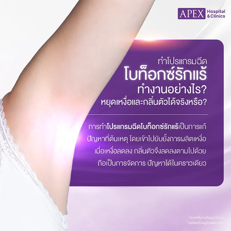 ฉีดโบท็อกซ์รักแร้