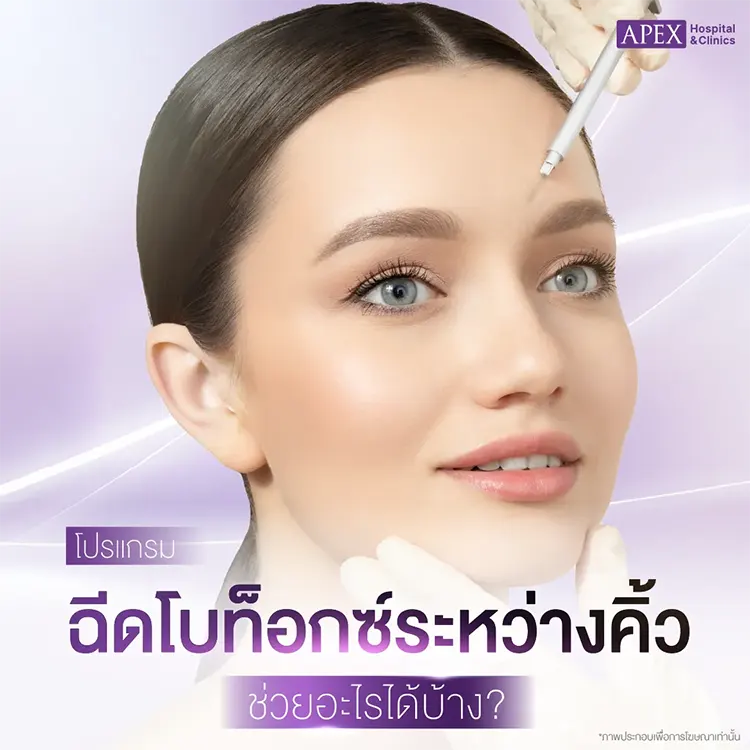 ฉีดโบท็อกซ์ระหว่างคิ้ว