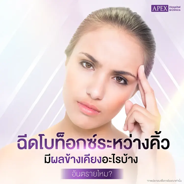 ฉีดโบท็อกซ์ระหว่างคิ้ว