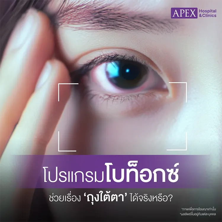 ฉีดโบท็อกถุงใต้ตาราคา