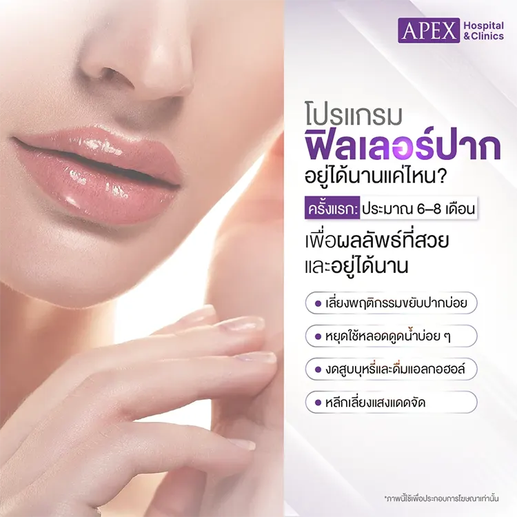 ฉีดปากราคา