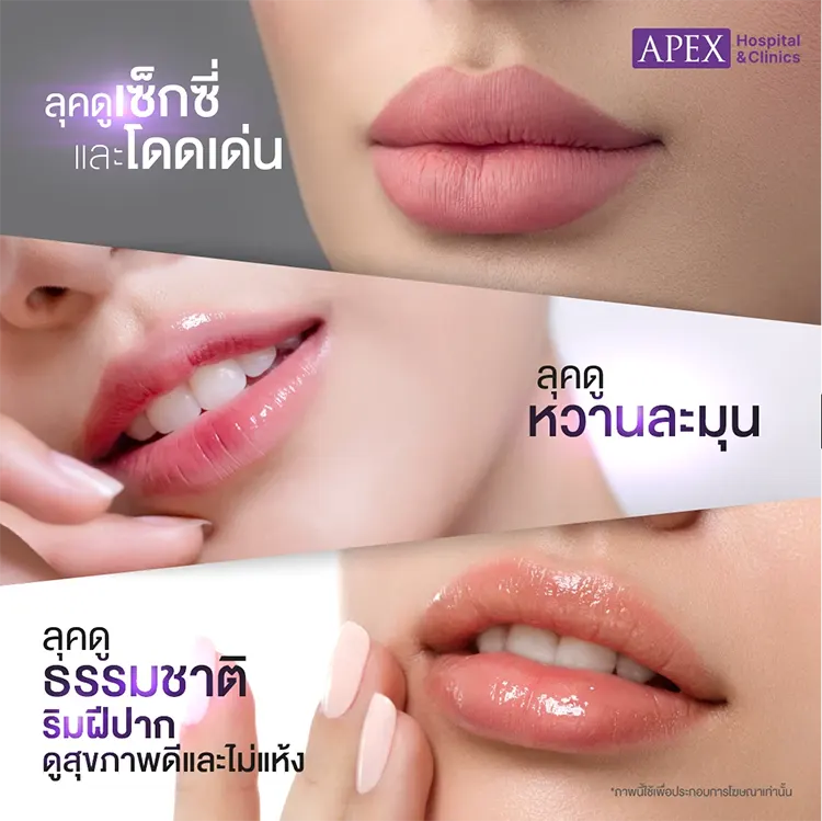 ฉีดปากราคา