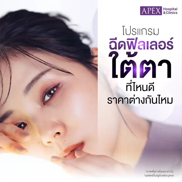 ฉีดฟิลเลอร์ใต้ตา