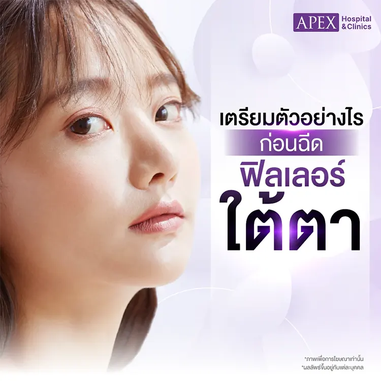 ฉีดฟิลเลอร์ใต้ตา