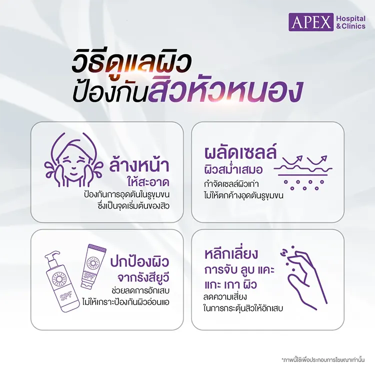 สิวหัวหนอง