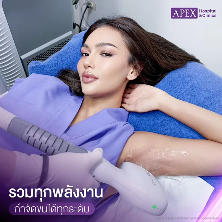 กำจัดขนรักแร้