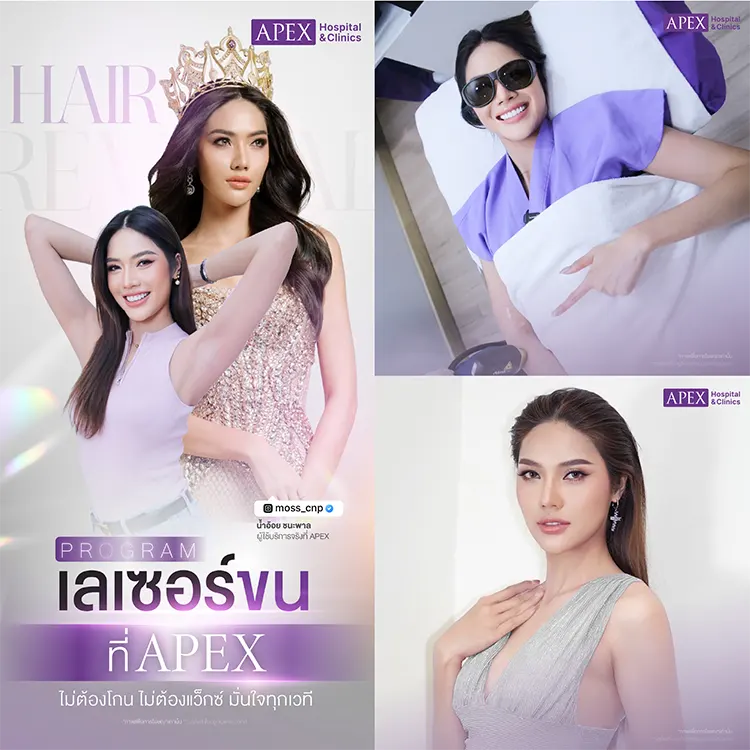 กำจัดขนขา