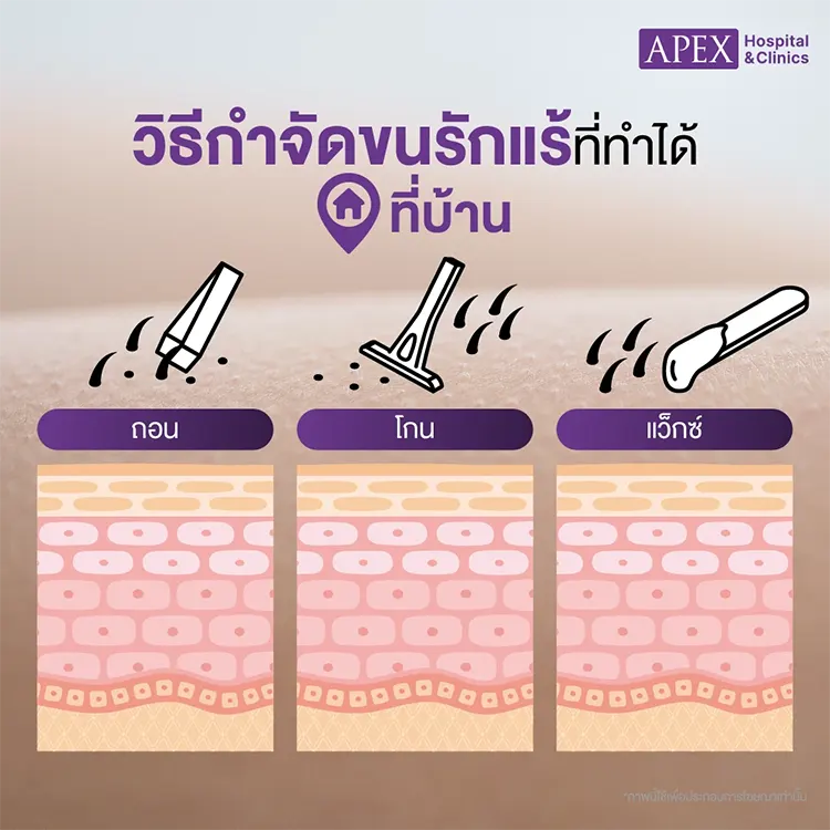 กำจัดขนรักแร้