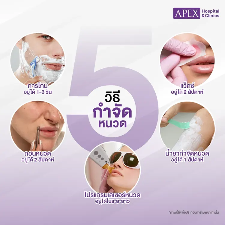 กำจัดหนวด