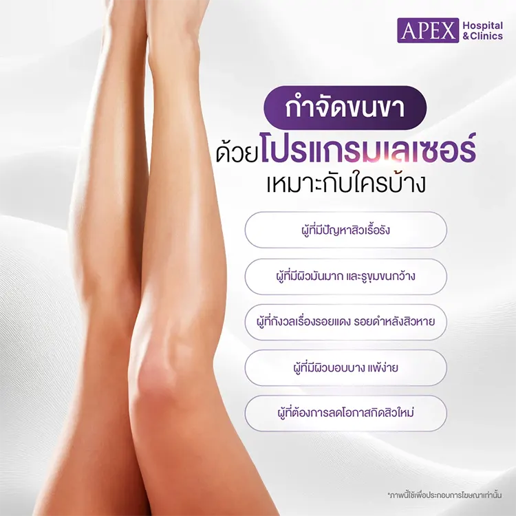 กำจัดขนขา