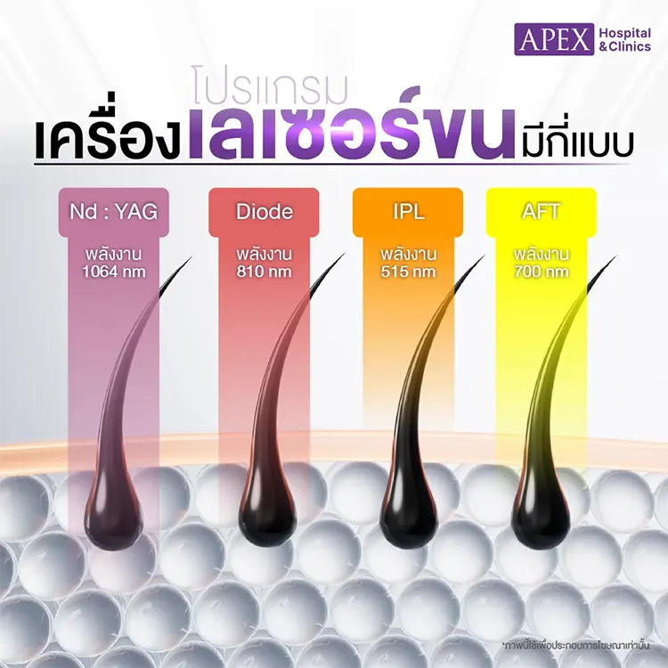 เครื่องเลเซอร์ขน