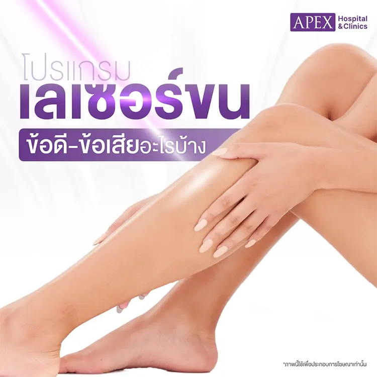 เครื่องเลเซอร์ขน