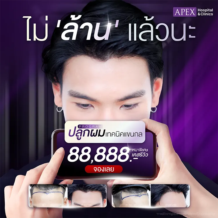 ปลูกผม