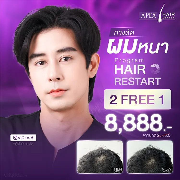 ปลูกผม