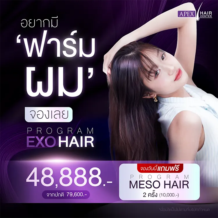 ปลูกผม