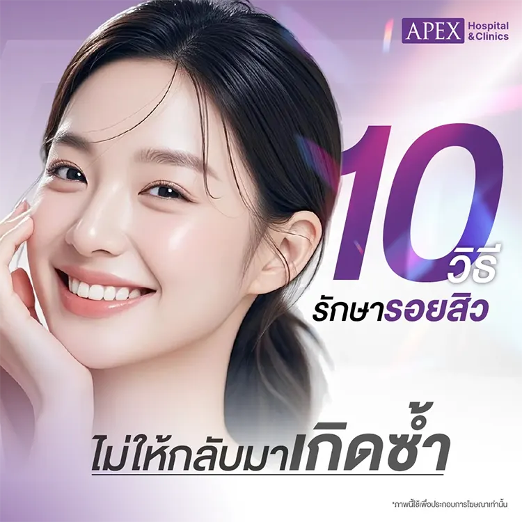 รอยสิว