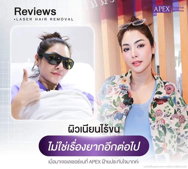 กำจัดขนขา