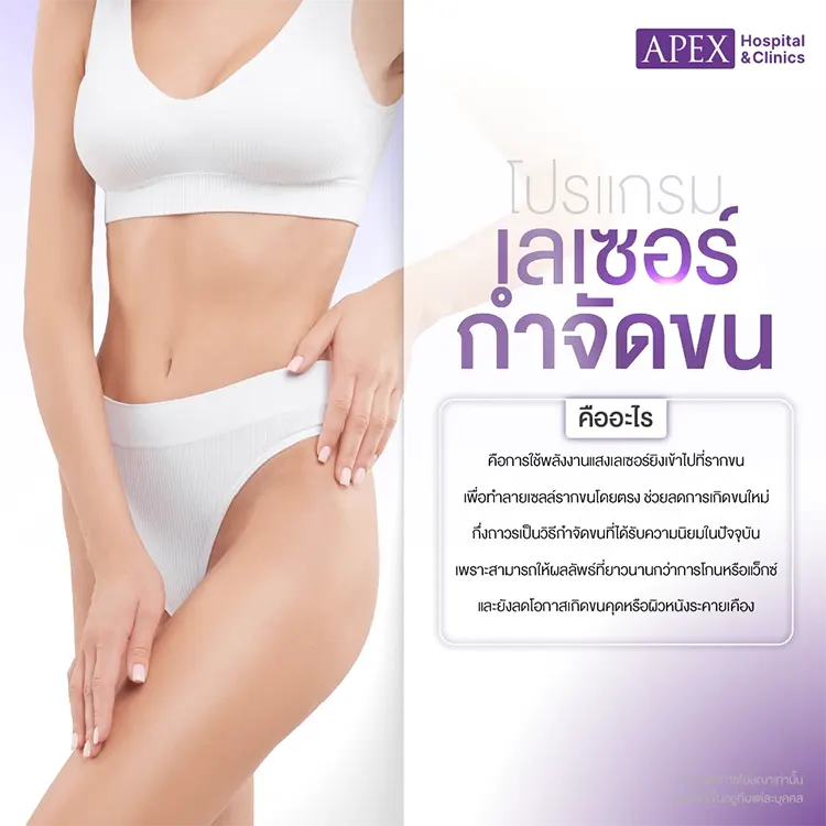 กำจัดขน