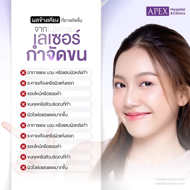 กำจัดขน