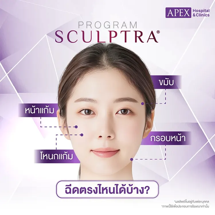 Sculptra เหมาะกับใคร