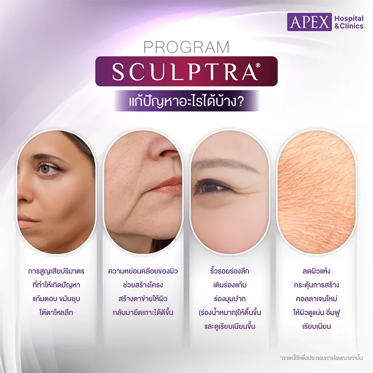 Sculptra ฉีดตรงไหนได้บ้าง