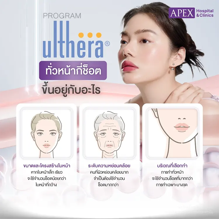 Ulthera ทั่วหน้ากี่ช็อต
