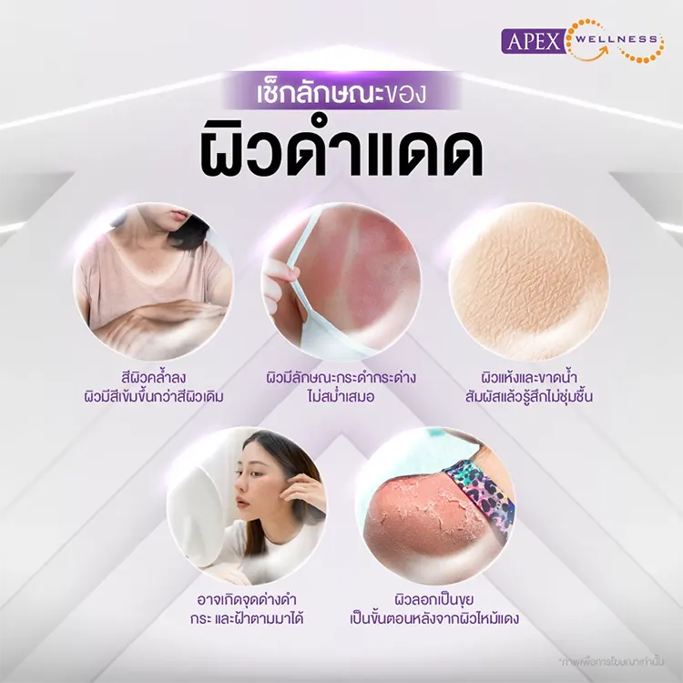 ผิวดำแดด