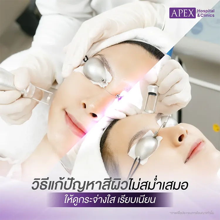 สีผิวไม่สม่ำเสมอ